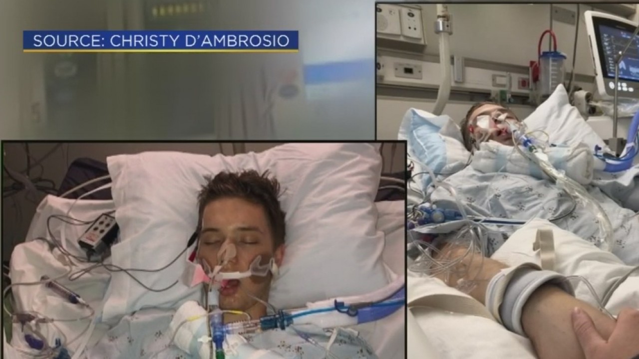 21-Year-Old In Coma For Complications Related To Vaping - CBS Sacramento thumbnail